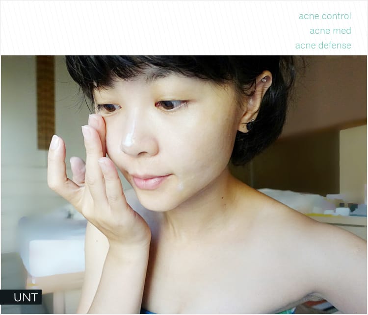 【美妝保養】UNT控油抗痘系列三部曲,平衡保濕讓油痘肌夏天也能好清爽! - 第14張圖 【美妝保養】UNT控油抗痘系列三部曲,平衡保濕讓油痘肌夏天也能好清爽!