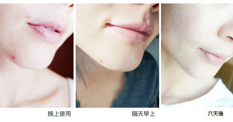 【美妝】Lancôme蘭蔻：超進化肌因小黑瓶x活性小黑安瓶～母親節精選逆齡透亮保養套組