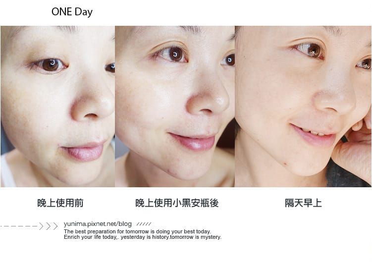 【美妝】Lancôme蘭蔻：超進化肌因小黑瓶x活性小黑安瓶～母親節精選逆齡透亮保養套組