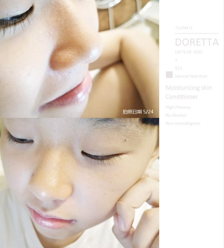 【保養】DORETTA朵芮:去粉刺用洗的就行 ~毛孔角栓潔顏布+潔膚慕斯 ” 三天就讓黑頭粉刺Out~ - 第23張圖 【保養】DORETTA朵芮:去粉刺用洗的就行 ~毛孔角栓潔顏布+潔膚慕斯 ” 三天就讓黑頭粉刺Out~