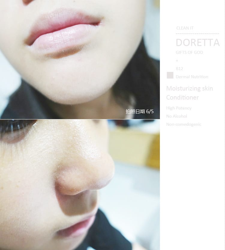 【保養】DORETTA朵芮:去粉刺用洗的就行 ~毛孔角栓潔顏布+潔膚慕斯 ” 三天就讓黑頭粉刺Out~ - 第24張圖 【保養】DORETTA朵芮:去粉刺用洗的就行 ~毛孔角栓潔顏布+潔膚慕斯 ” 三天就讓黑頭粉刺Out~