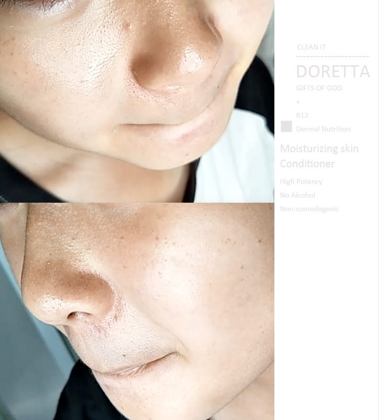 【保養】DORETTA朵芮:去粉刺用洗的就行 ~毛孔角栓潔顏布+潔膚慕斯 ” 三天就讓黑頭粉刺Out~ - 第17張圖 【保養】DORETTA朵芮:去粉刺用洗的就行 ~毛孔角栓潔顏布+潔膚慕斯 ” 三天就讓黑頭粉刺Out~