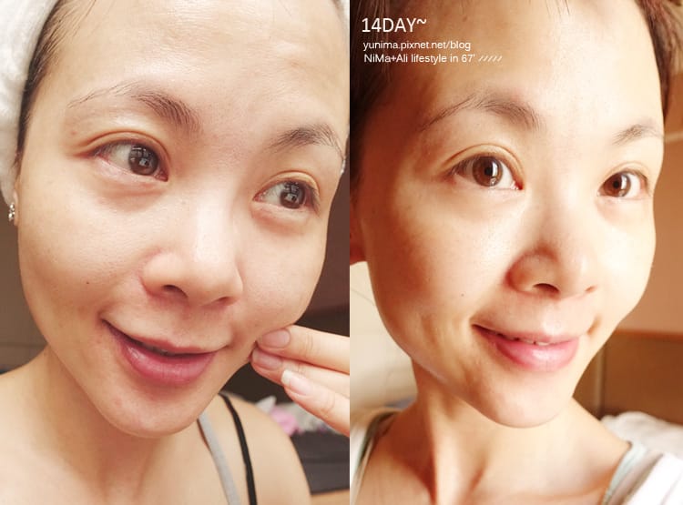 【抗老保養】喚顏緊緻彈潤肌不顯老~瑞曼爾ReverSkin打造緊顏無痕肌 - 第34張圖 【抗老保養】喚顏緊緻彈潤肌不顯老~瑞曼爾ReverSkin打造緊顏無痕肌